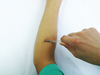 Medical Devices Surgical Sterile and Multi-functional Skin Sutures