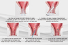 Clinic Medicine Devices Minimally Invasive Hemorrhoid Sugery Disposable Appliance Medical Ligature